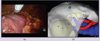 Advances in image-guided systems in liver, kidney, and pancreatic surgery (Figure 1).