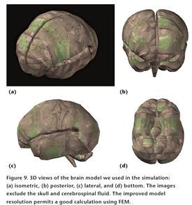 Figure 9 - 3D views of the brain model used in the simulation.