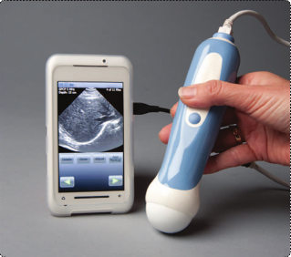 Figure 1. Mobisante developed a complete phone-and-ultrasound package that offers low cost, ease of use, and portability. The company believes it will be especially beneficial in low-resource settings, such as rural areas and developing countries. (Photo courtesy of Mobisante.)