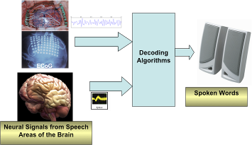 Figure 1:  Diagram of a speech BMI. Electrocorticogram (ECoG) signals from electrodes located over the speech areas (top path) or the neural spike signals recorded with implanted microelectrodes (bottom path) are decoded to reverse engineer speech. The current procedure is to relate a specific set of ECoG signal patterns to a selected library of spoken words, but the dream is to develop a sufficient 'vocabulary' of spoken words to reverse engineer speech from brain rhythms (graphics assembled from various posted or published pictures) 