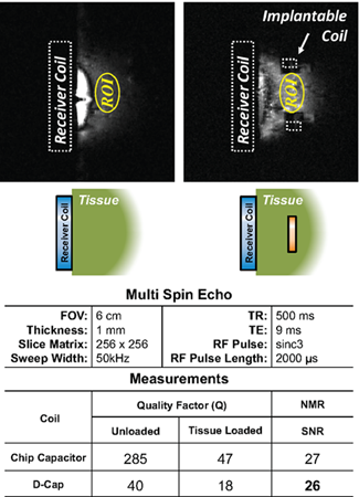 Figure 2: Two dimensional NMR images from a multiple spin echo measurement in an 11.1 Tesla magnetic field strength using a tissue loaded surface coil with comparison to the inclusion of the programmable resonant implant coil.