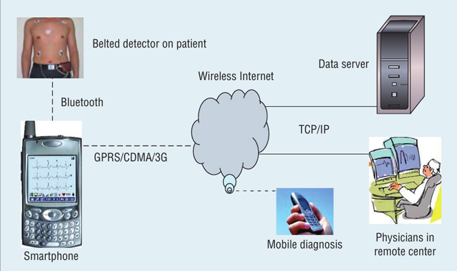 Figure 2. The remote diagnosis service system. Its basic components are a belted detector, a smartphone, a data server, a diagnosis terminal, and short- and long- distance wireless modules.