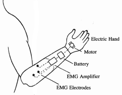 Figure 3: Myoelectric based electric-powered devices