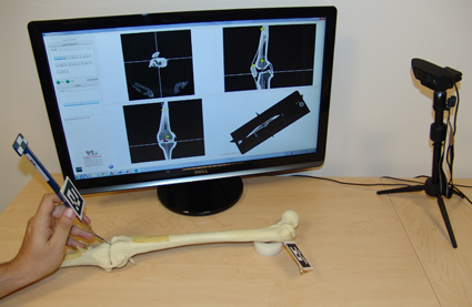 Figure 1: Low cost tabletop simulation environment for navigation guidance. Sawbone model used as mock patient and tracking is performed by a webcam. Interface shows standard radiological views corresponding to the location of the tip of the pointer tool.