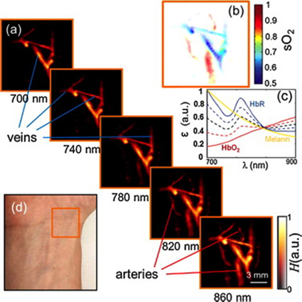 Figure 2. Multispectral tomographic reconstructions of the wrist region. (a) Volumetric (maximum intensity projection along the depth direction) images acquired at 5 different wavelengths in the near-infrared. Two main types of vessels (arteries and veins) can be readily identified by their spectral behavior. (b) Map of blood oxygen saturation, as calculated from images acquired at the different wavelengths. (c) Extinction (absorption) spectra of major tissue chromophores in arbitrary units. The curves for hemoglobin are shown for 100% oxygenation (continuous red line), 75% oxygenation (dashed red line), 50% oxygenation (dashed black line), 25% oxygenation (dashed blue line), and 0% oxygenation (continuous blue line). (d) Color photograph of the imaged region. Image courtesy: Xosé Luís Deán-Ben and Daniel Razansky, Photoacoustics, vol. 1, no. 3, 2014. 